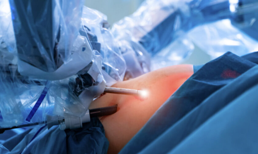 Discover the Benefits of Single Anastomosis Gastric Bypass in Sunshine Coast