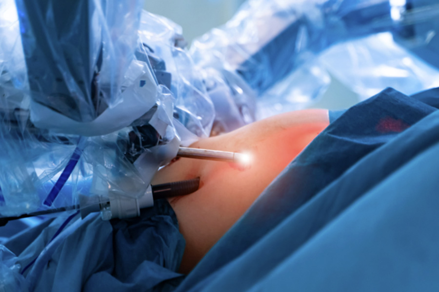 Discover the Benefits of Single Anastomosis Gastric Bypass in Sunshine Coast