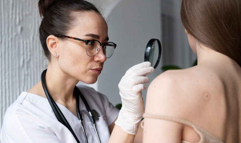 5 Reasons Why Patch Testing Is Essential Before Laser Treatment for Melasma