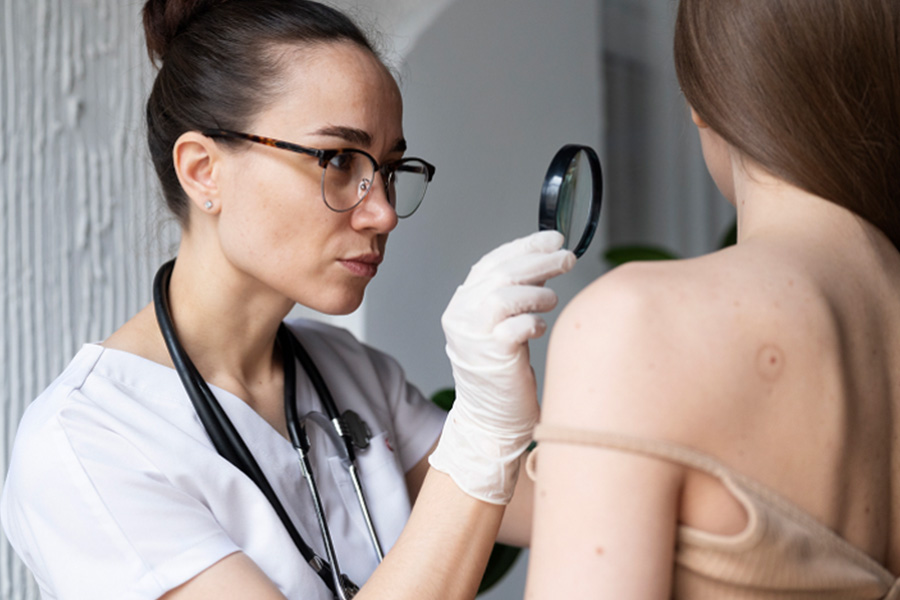 5 Reasons Why Patch Testing Is Essential Before Laser Treatment for Melasma